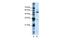 KH RNA Binding Domain Containing, Signal Transduction Associated 3 antibody, GTX47342, GeneTex, Western Blot image 