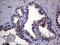Uracil Phosphoribosyltransferase Homolog antibody, LS-C795167, Lifespan Biosciences, Immunohistochemistry paraffin image 