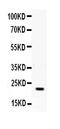 Interferon Gamma antibody, RP1001, Boster Biological Technology, Western Blot image 