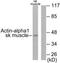 Actin, alpha skeletal muscle antibody, TA313417, Origene, Western Blot image 