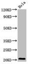 ADP Ribosylation Factor Like GTPase 1 antibody, CSB-PA002070LA01HU, Cusabio, Western Blot image 