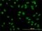 TATA-Box Binding Protein Associated Factor 11 antibody, H00006882-M04, Novus Biologicals, Immunofluorescence image 