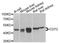 CD72 Molecule antibody, A9930, ABclonal Technology, Western Blot image 