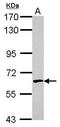 Crossover junction endonuclease EME1 antibody, PA5-27114, Invitrogen Antibodies, Western Blot image 