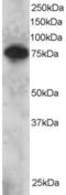 SET Domain And Mariner Transposase Fusion Gene antibody, LS-C55457, Lifespan Biosciences, Western Blot image 