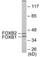 Forkhead Box B1 antibody, EKC1904, Boster Biological Technology, Western Blot image 