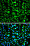 TEK Receptor Tyrosine Kinase antibody, 22-794, ProSci, Immunofluorescence image 