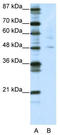 PLAG1 Like Zinc Finger 1 antibody, TA343632, Origene, Western Blot image 