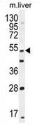 Thymocyte Selection Associated antibody, AP54239PU-N, Origene, Western Blot image 