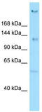 Centrosomal Protein 135 antibody, TA337980, Origene, Western Blot image 