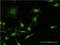 CO4 antibody, H00000721-M03, Novus Biologicals, Immunocytochemistry image 