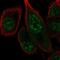 FA Complementation Group M antibody, NBP2-55444, Novus Biologicals, Immunofluorescence image 