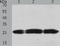 TIMP Metallopeptidase Inhibitor 4 antibody, TA321565, Origene, Western Blot image 