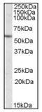 CES2 antibody, AP08791PU-N, Origene, Western Blot image 