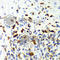 Capping Actin Protein, Gelsolin Like antibody, A7324, ABclonal Technology, Immunohistochemistry paraffin image 