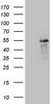 Leucine Rich Repeat Containing 6 antibody, TA805971S, Origene, Western Blot image 