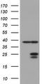 Ubiquitin Conjugating Enzyme E2 E3 antibody, TA800058AM, Origene, Western Blot image 