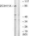 Zinc Finger CCCH-Type Containing 11A antibody, abx015010, Abbexa, Western Blot image 