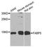 Fatty Acid Binding Protein 5 antibody, A0947, ABclonal Technology, Western Blot image 