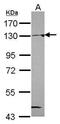 N-Acetyltransferase 10 antibody, PA5-31376, Invitrogen Antibodies, Western Blot image 