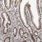 Zinc Finger Protein 830 antibody, HPA027211, Atlas Antibodies, Immunohistochemistry frozen image 