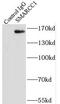 SWI/SNF Related, Matrix Associated, Actin Dependent Regulator Of Chromatin Subfamily C Member 1 antibody, FNab08009, FineTest, Immunoprecipitation image 