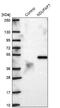 NADH:Ubiquinone Oxidoreductase Complex Assembly Factor 7 antibody, NBP1-91728, Novus Biologicals, Western Blot image 