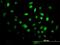 Forkhead box protein F2 antibody, H00002295-M08, Novus Biologicals, Immunofluorescence image 