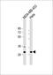Bisphosphoglycerate Mutase antibody, 56-539, ProSci, Western Blot image 