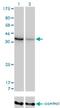 Aldo-Keto Reductase Family 1 Member D1 antibody, H00006718-M03, Novus Biologicals, Western Blot image 