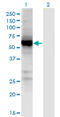 UDP Glucuronosyltransferase Family 2 Member B7 antibody, LS-C198407, Lifespan Biosciences, Western Blot image 