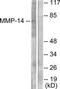 Matrix Metallopeptidase 14 antibody, TA312180, Origene, Western Blot image 