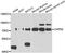Calpain 5 antibody, A08350, Boster Biological Technology, Western Blot image 