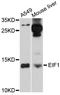 Eukaryotic Translation Initiation Factor 1 antibody, abx125803, Abbexa, Western Blot image 