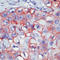 ERBB2 antibody, LS-C88611, Lifespan Biosciences, Immunohistochemistry frozen image 