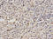 PP4 antibody, A06390, Boster Biological Technology, Immunohistochemistry paraffin image 