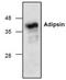 Complement Factor D antibody, TA319009, Origene, Western Blot image 