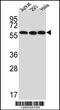U3 small nucleolar RNA-associated protein 6 homolog antibody, 61-874, ProSci, Western Blot image 