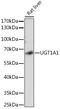 UDP Glucuronosyltransferase Family 1 Member A1 antibody, GTX55835, GeneTex, Western Blot image 