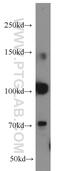 RNA Binding Motif Protein 15B antibody, 22249-1-AP, Proteintech Group, Western Blot image 