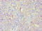 Fibroblast Growth Factor Binding Protein 1 antibody, LS-C377572, Lifespan Biosciences, Immunohistochemistry paraffin image 