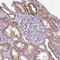 Mitochondrially Encoded NADH:Ubiquinone Oxidoreductase Core Subunit 4 antibody, HPA053928, Atlas Antibodies, Immunohistochemistry paraffin image 