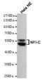 Nuclear Factor I C antibody, M04154, Boster Biological Technology, Western Blot image 