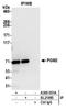 Phosphoglucomutase 2 antibody, A305-551A, Bethyl Labs, Immunoprecipitation image 