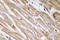 Bone Morphogenetic Protein 5 antibody, LS-C291672, Lifespan Biosciences, Immunohistochemistry paraffin image 