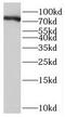SKI Like Proto-Oncogene antibody, FNab07894, FineTest, Western Blot image 