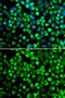 ATPase H+ Transporting Accessory Protein 2 antibody, GTX64438, GeneTex, Immunocytochemistry image 