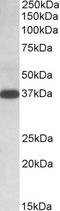 Isocitrate Dehydrogenase (NAD(+)) 3 Alpha antibody, TA348974, Origene, Western Blot image 