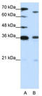 PR/SET Domain 13 antibody, TA345337, Origene, Western Blot image 