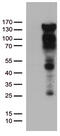 Progesterone Receptor antibody, TA802718AM, Origene, Western Blot image 